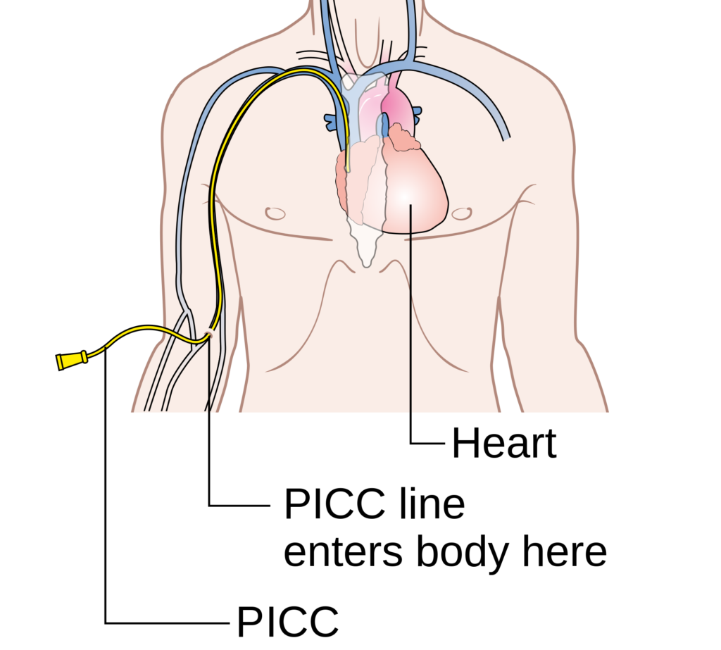 PICC line diagram