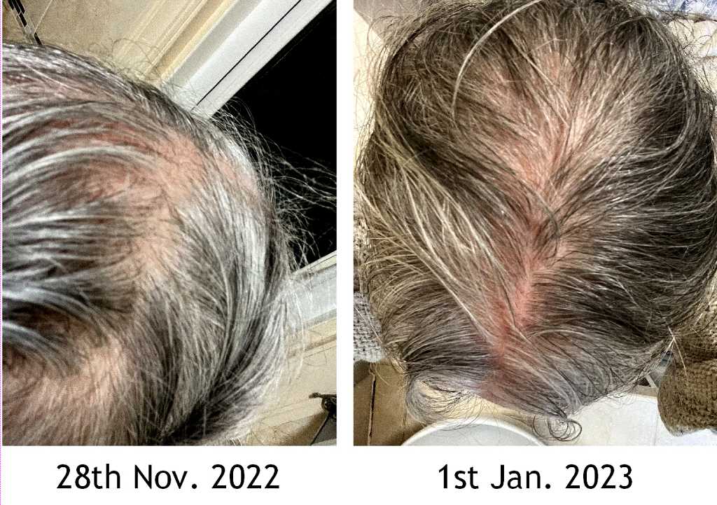 Read more about the article Hair Care Update – One Month In